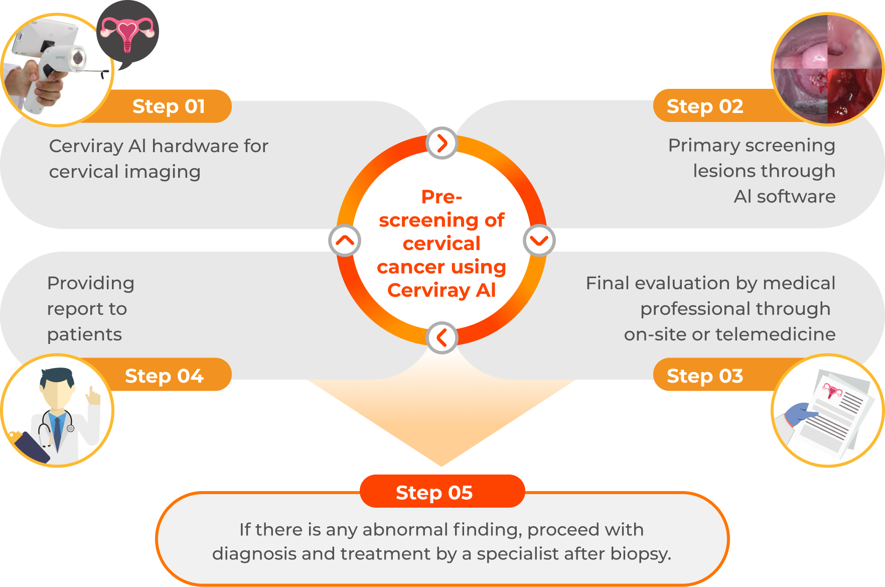 Cerviray AI steps ENG desktop 1.5x