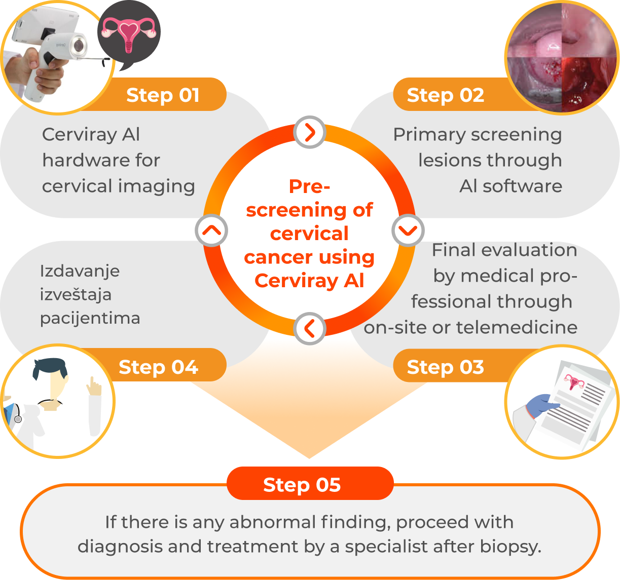 Cerviray AI steps ENG mobile 1.5x